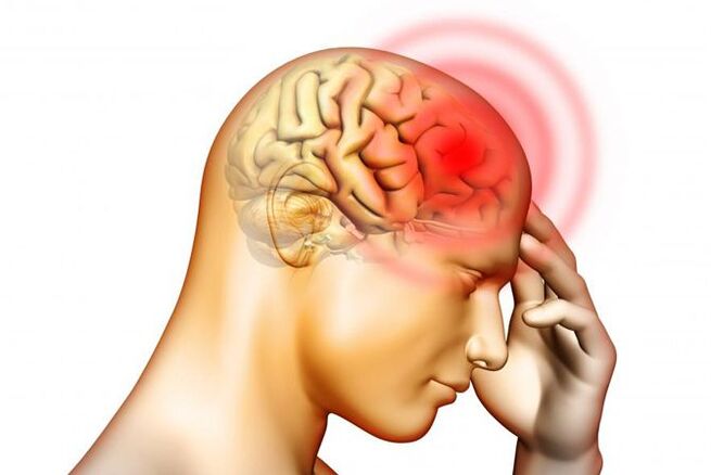Il mal di testa può essere un sintomo della presenza di larve di ascaridi nell'orecchio medio